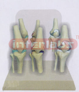 DESK-TYPE, DISEASE FIXED JOINTS MODEL WITH DESCRIPTION PLATE